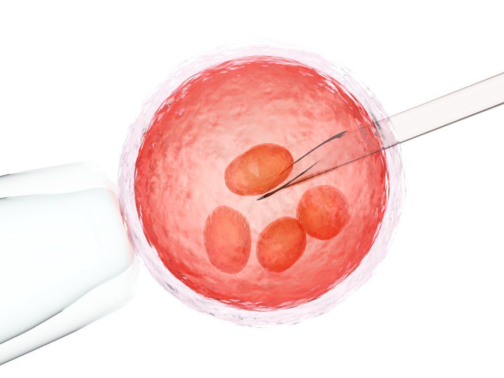 rata de succes FIV cu un singur embrion