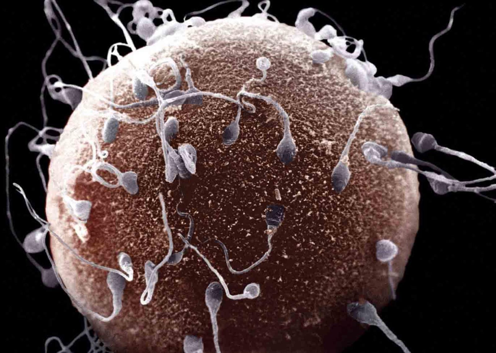 Cum se crește concentrația spermei în lichidul seminal
